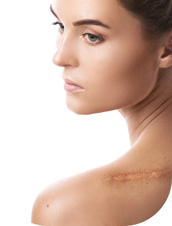 young-woman-with-scar-her-shoulder